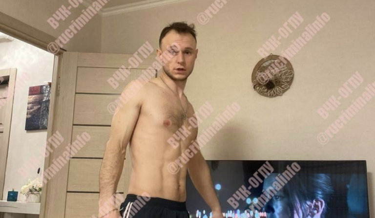 Putin-Blackmail is suspected, in a coma-accident or message?